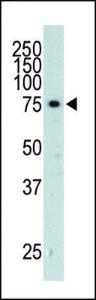 Anti-ADRBK2 Rabbit Polyclonal Antibody (FITC (Fluorescein))