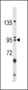 Anti-BICC1 Rabbit Polyclonal Antibody (PE (Phycoerythrin))