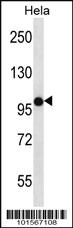 Anti-FGFR2 Rabbit Polyclonal Antibody