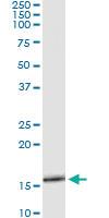 Anti-SLURP1 Antibody Pair