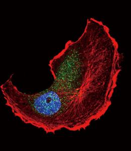 Anti-TSC2 Rabbit Polyclonal Antibody