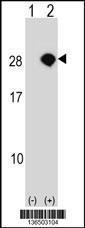 Anti-AKIRIN2 Rabbit Polyclonal Antibody (AP (Alkaline Phosphatase))