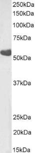 Antibody anti-TBXA2R 100 µg