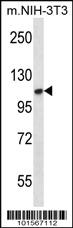 Anti-FGFR2 Rabbit Polyclonal Antibody