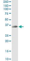 Anti-STX12 Antibody Pair