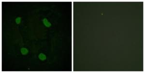 Immunofluorescence analysis of HeLa cells using Anti-Histone H3 (acetyl Lys14) Antibody. The right hand panel represents a negative control, where the antibody was pre-incubated with the immunising peptide.