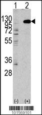 Anti-FGFR2 Rabbit Polyclonal Antibody