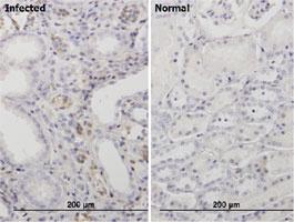 Anti-BKPyVgp4 Mouse Monoclonal Antibody [clone: 6E10]