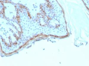 Immunohistochemical analysis of formalin-fixed, paraffin-embedded human skin tissue using Anti-Filaggrin Antibody [rFLG/1945]