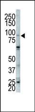 Anti-FGFR2 Rabbit Polyclonal Antibody