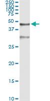 Anti-SERPINB3 Antibody Pair