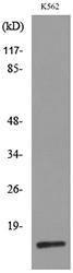 Western blot analysis of lysate from K562 cells using Anti-RBP2 Antibody