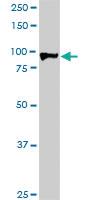 Anti-HIC1 Mouse Monoclonal Antibody [clone: 2F9]