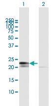 Anti-RPL29 Mouse Polyclonal Antibody