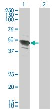 Anti-TFAP2B Mouse Monoclonal Antibody [clone: 2F6]