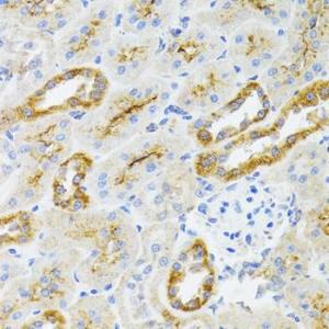 Immunohistochemistry analysis of paraffin-embedded rat kidney using Anti-AIFM3 Antibody (A10467) at a dilution of 1:100 (40X lens). Perform microwave antigen retrieval with 10 mM PBS buffer pH 7.2 before commencing with IHC staining protocol