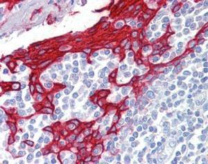 Anti-KRT13 Antibody (A82524) (25 µg/ml) staining of paraffin embedded Human Tonsil Steamed antigen retrieval with citrate buffer pH 6, AP-staining