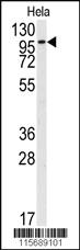 Anti-FGFR2 Rabbit Polyclonal Antibody