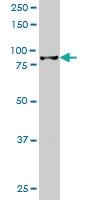 Anti-HIC1 Mouse Monoclonal Antibody [clone: 2F9]