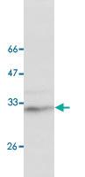 Anti-STOM Mouse Monoclonal Antibody [clone: 13]