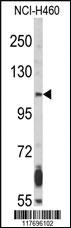 Anti-SPATA18 Rabbit Polyclonal Antibody