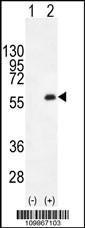 Anti-MYT1 Rabbit Polyclonal Antibody (AP (Alkaline Phosphatase))