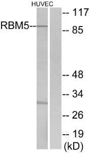 Antibody anti-RBM5 100 µg