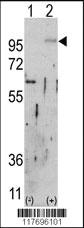 Anti-SPATA18 Rabbit Polyclonal Antibody