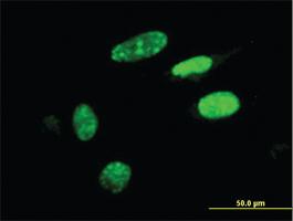 Anti-HIC1 Mouse Monoclonal Antibody [clone: 2F9]