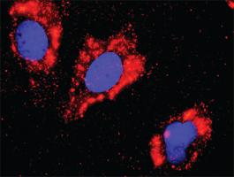 Anti-FLT1 + CTNNB1 Antibody Pair