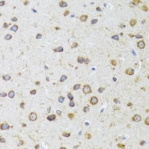 Immunohistochemistry analysis of paraffin-embedded mouse brain using Anti-AIFM3 Antibody (A10467) at a dilution of 1:100 (40X lens). Perform microwave antigen retrieval with 10 mM PBS buffer pH 7.2 before commencing with IHC staining protocol