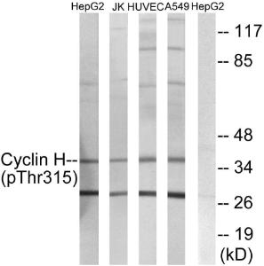 Western blot analysis of lysates from HepG2 cells, Jurkat cells, HUVEC cells and A549 cells using Anti-Cyclin H (phospho Thr315) Antibody. The right hand lane represents a negative control, where the antibody is blocked by the immunising peptide.