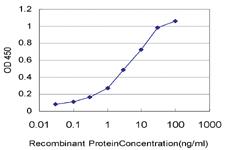 Anti-HIC1 Mouse Monoclonal Antibody [clone: 2F9]