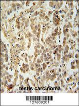 Anti-LUZP4 Rabbit Polyclonal Antibody (Biotin)