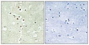 Immunohistochemical analysis of paraffin-embedded human brain using Anti-Cyclin H (phospho Thr315) Antibody 1:100 (4°C overnight). The right hand panel represents a negative control, where the antibody was pre-incubated with the immunising peptide.