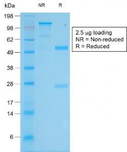 SDS-PAGE analysis of Anti-Tyrosinase Antibody [TYR/2024R] under non-reduced and reduced conditions; showing intact IgG and intact heavy and light chains, respectively. SDS-PAGE analysis confirms the integrity and purity of the antibody.