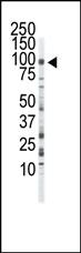 Anti-FGFR3 Rabbit Polyclonal Antibody