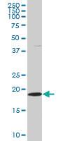 Anti-SKP1 Mouse Monoclonal Antibody [clone: 2E6]