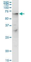 Anti-LARP6 Rabbit Polyclonal Antibody