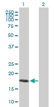 Anti-MRAP Mouse Polyclonal Antibody