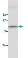 Anti-ITLN1 Mouse Monoclonal Antibody [clone: 17]