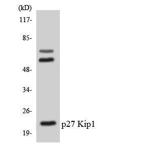 Antibody anti-P27 KIP1 A99957-100 100 µg