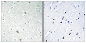 Immunohistochemical analysis of paraffin-embedded human brain using Anti-FOXR1 Antibody 1:100 (4°C overnight). The right hand panel represents a negative control, where the antibody was pre-incubated with the immunising peptide.