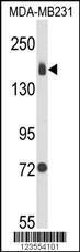 Anti-ITGA2 Rabbit Polyclonal Antibody (HRP (Horseradish Peroxidase))