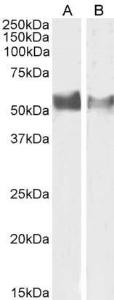 Anti-LAG3 Antibody (A82528) (1 µg/ml) staining of Human Lymph Node (A) and (0.5 µg/ml) Tonsil (B) lysate (35 µg protein in RIPA buffer). Primary incubation was 1 hour. Detected by chemiluminescence