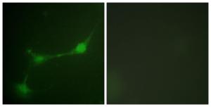 Immunofluorescence analysis of NIH/3T3 cells using Anti-Ataxin 1 (phospho Ser776) Antibody. The right hand panel represents a negative control, where the Antibody was pre-incubated with the immunising peptide