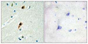 Antibody anti-RBM5 100 µg