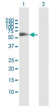 Anti-FSD1 Rabbit Polyclonal Antibody