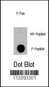 Anti-TSC2 Rabbit Polyclonal Antibody (AP (Alkaline Phosphatase))