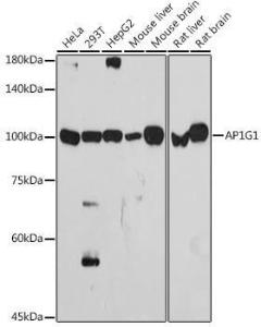 Western blot analysis of extracts of various cell lines, using Anti-gamma Adaptin Antibody [ARC2440] (A308552) at 1:1,000 dilution